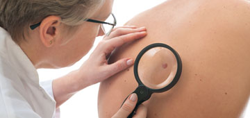 Skin Cancer Clinic